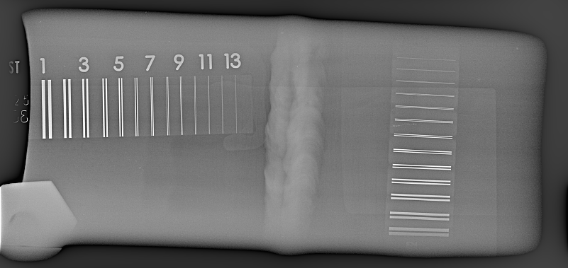 Radiography (X & γ Ray) - X-Ray - Image Quality - Duplex