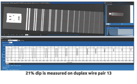 Radiography (X & Y Ray) - CR - Computed Radiography - SignalX - SignalX ...