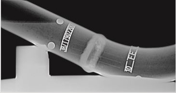 logos-imaging-orama-II-dr-system-tube
